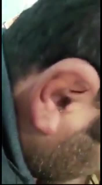 Разное. Удаляем из уха.