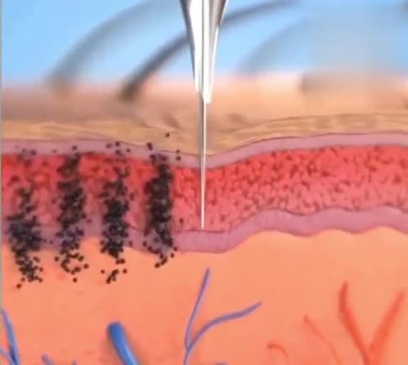 Мое здоровье. Тату. Что нужно знать?